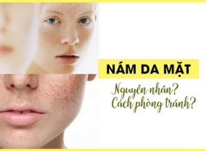 Tình Trạng Nám Da, Tàn Nhang Ở Phụ Nữ - Nguyên Nhân Và Cách Phòng Tránh